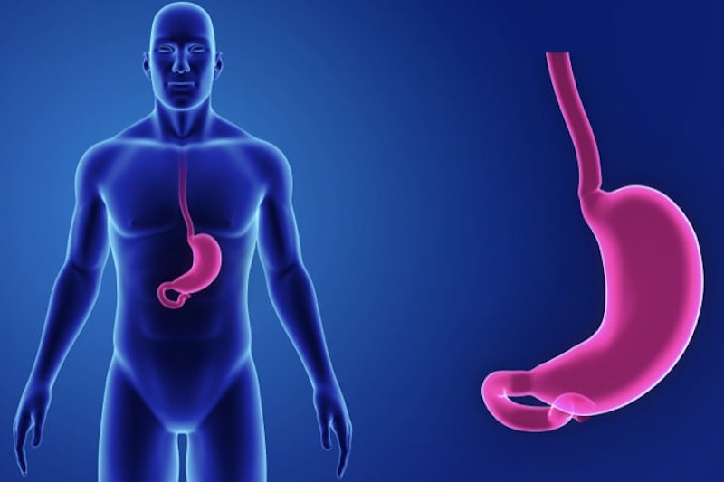 Illustrazione 3d di uno stomaco per descrivere la gastroenterite