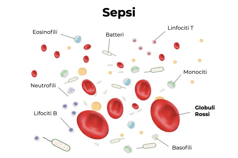 Illustrazione per rappresentare sangue e possibili agenti causanti sepsi