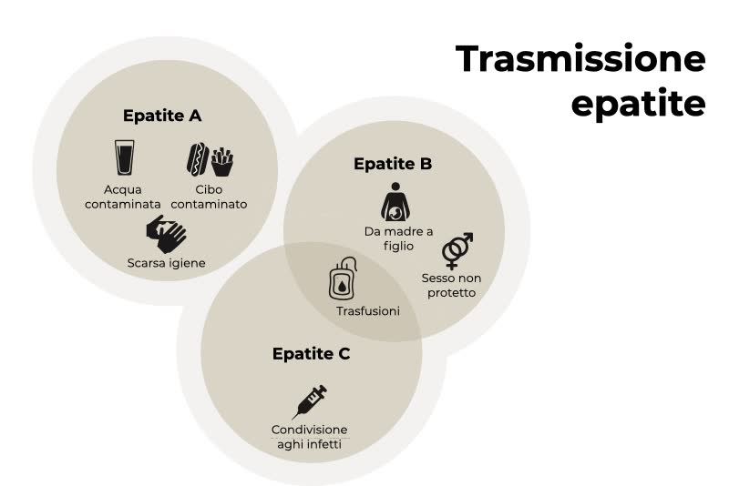 Illustrazione per descrivere le varie modalità di trasmissione delle epatiti, tra cui l'epatite B