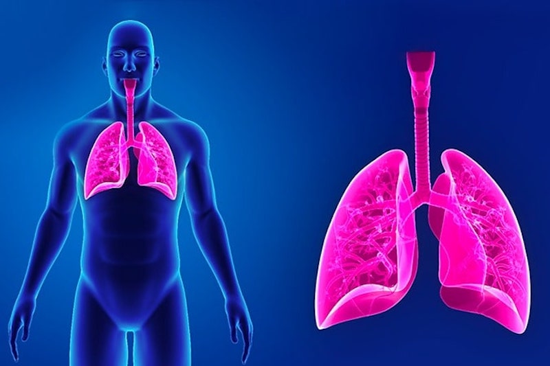 Microcitoma (Carcinoma polmonare a piccole cellule)