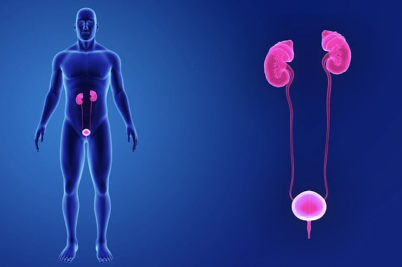 Uretrocele (Ureterocele)