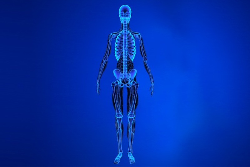 Osteoporosi