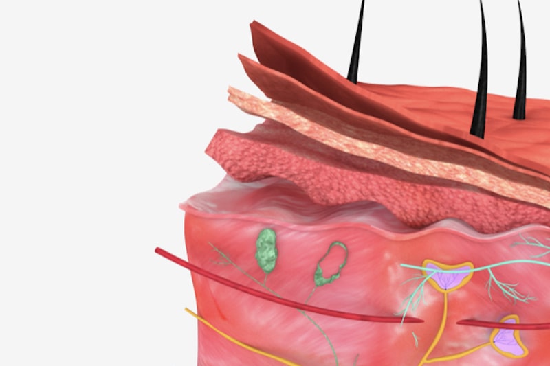 Chirurgia dermatologica