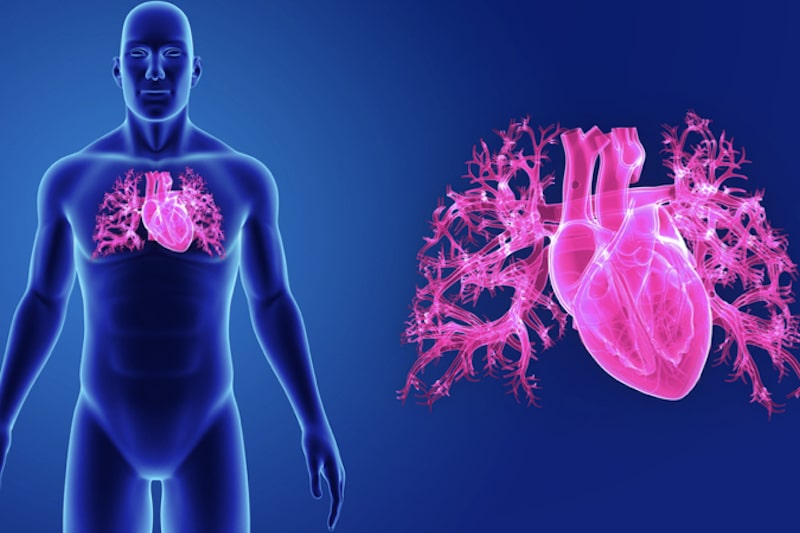 Cardioversione elettrica (CVE)