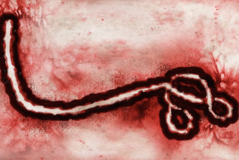 Malattia da virus Ebola