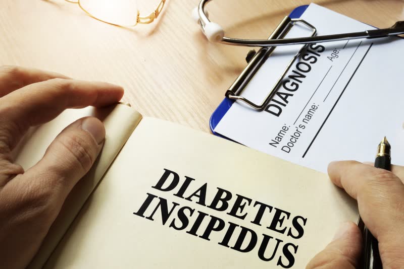 Diabete insipido